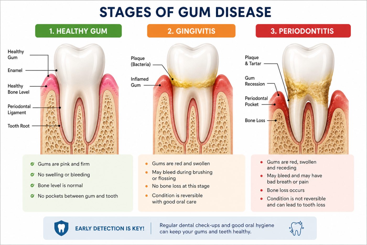 Gingivitis versus periodontitis stages explained by dentist at The White Dental Practice, your 'dental clinic near me', in Mankapur Nagpur
