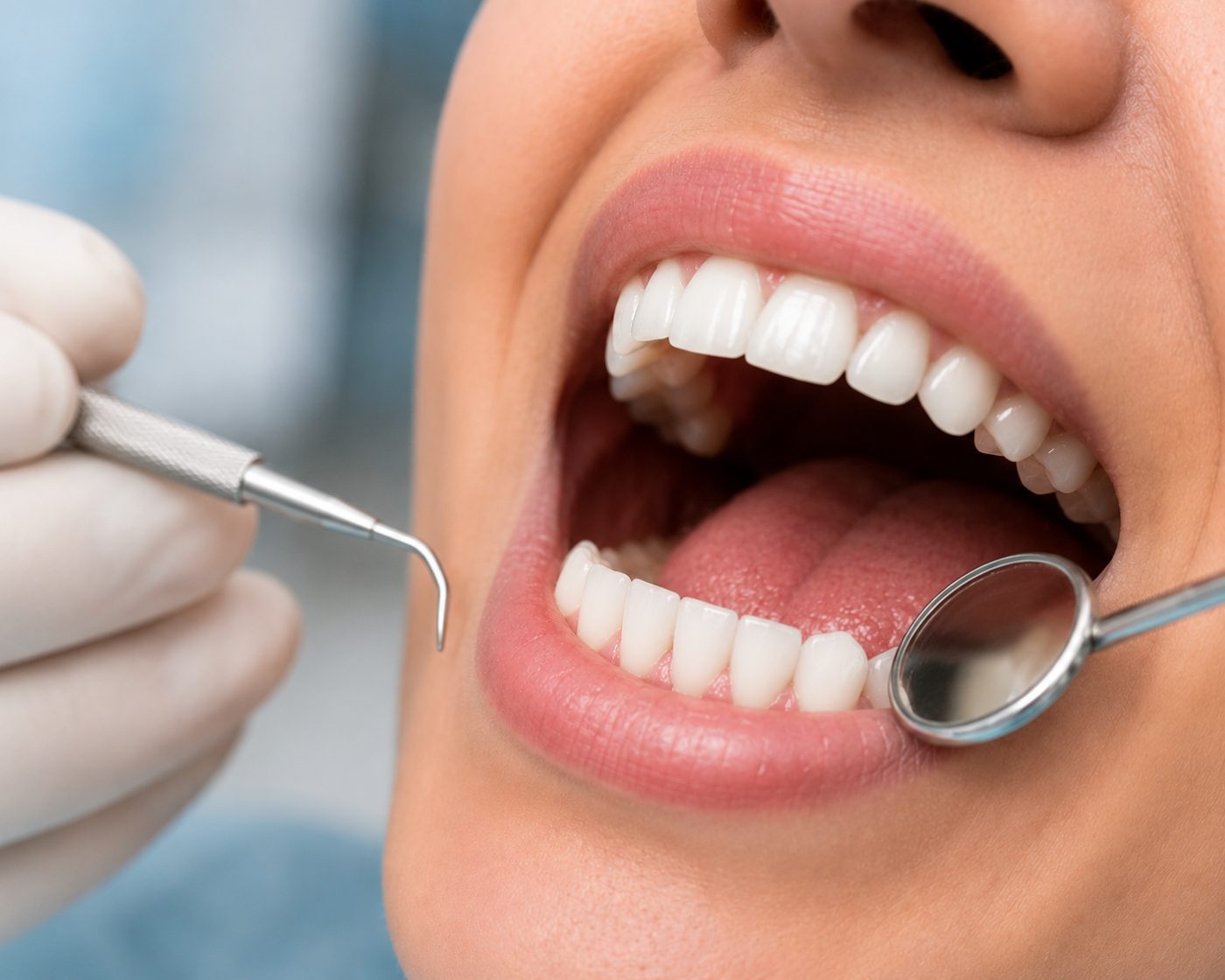Safe teeth scaling explained by dentist at The White Dental Practice, your 'dental clinic near me', in Mankapur Nagpur