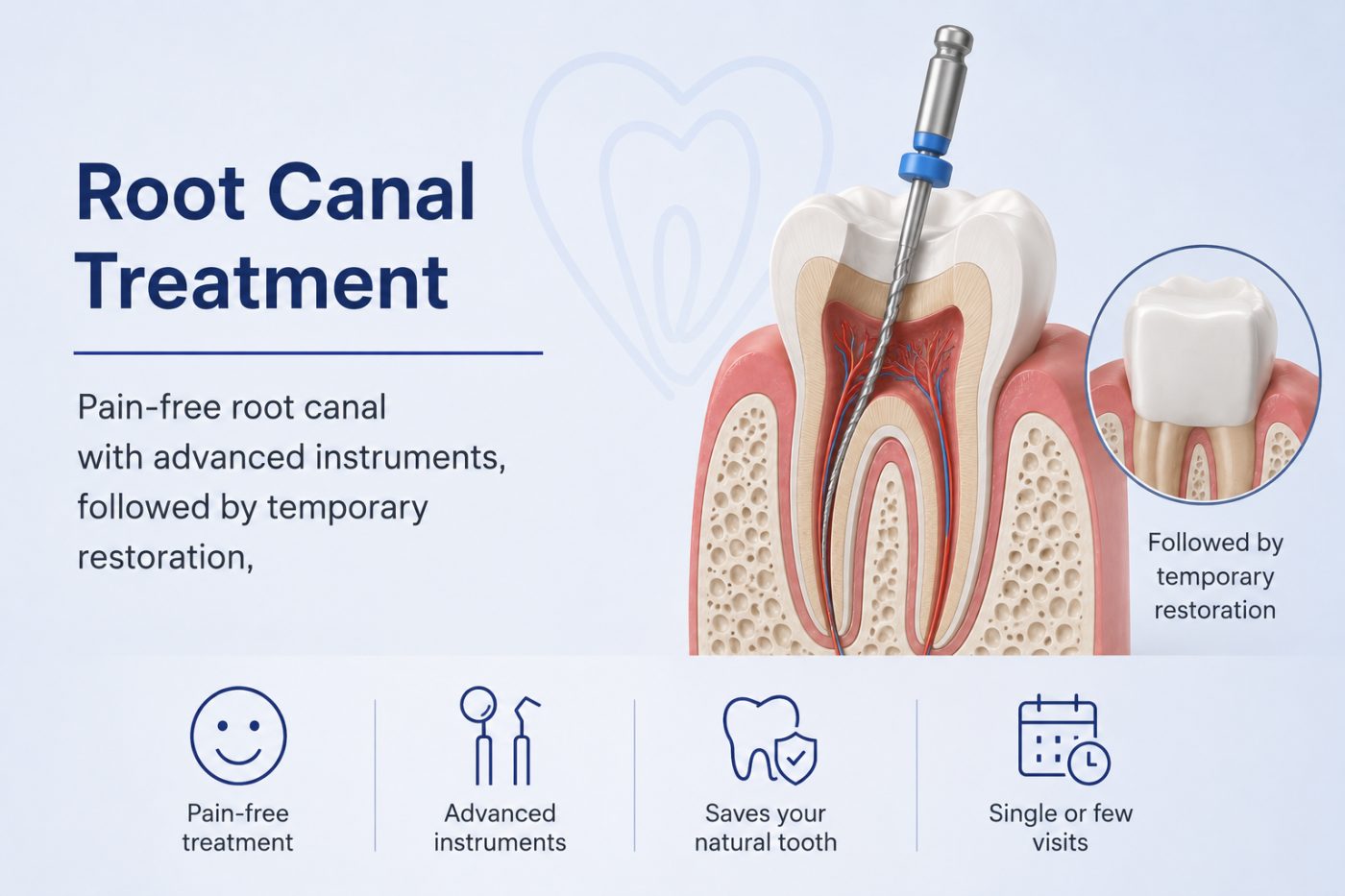 What a root canal is explained by dentist at The White Dental Practice, your 'dental clinic near me', in Mankapur Nagpur