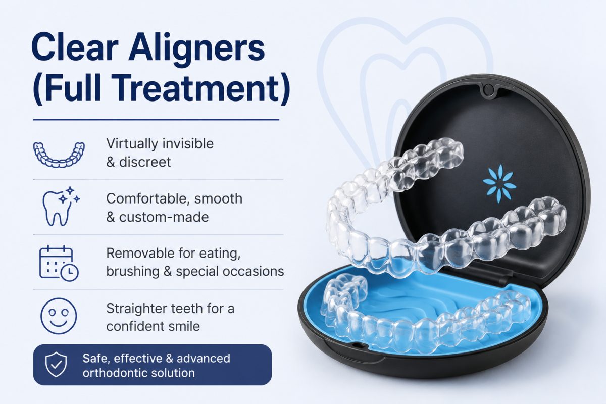Clear Aligners with dentist at The White Dental Practice, dental clinic near me in Mankapur Nagpur