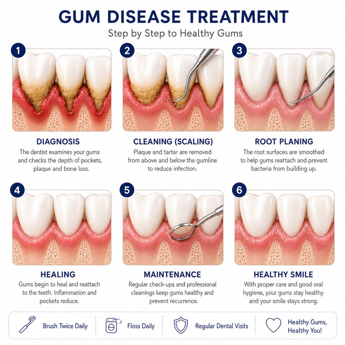 Gum Treatment with dentist at The White Dental Practice, dental clinic near me in Mankapur Nagpur